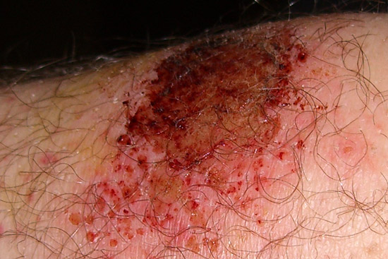 Knie